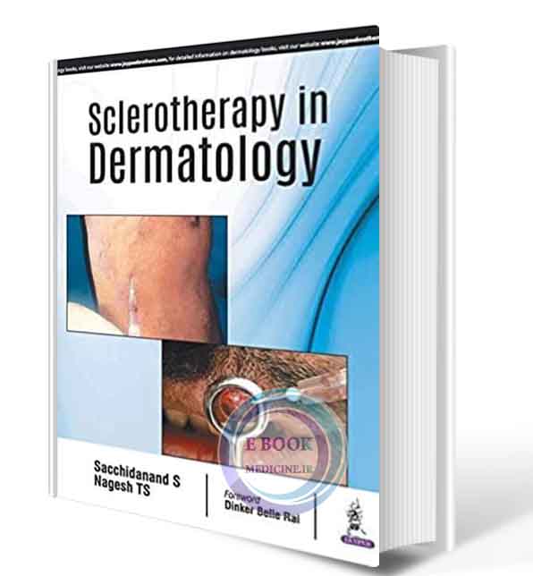 دانلود کتاب  Sclerotherapy in Dermatology 2021 (ORIGINAL PDF)